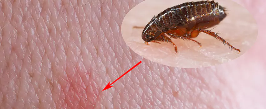 Flea Control for Humans Wylie, TX